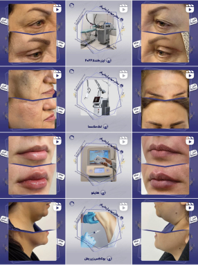 طراحی یونیفرم پست پیج اینستاگرام